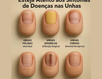 O que suas unhas estão revelando sobre sua saúde